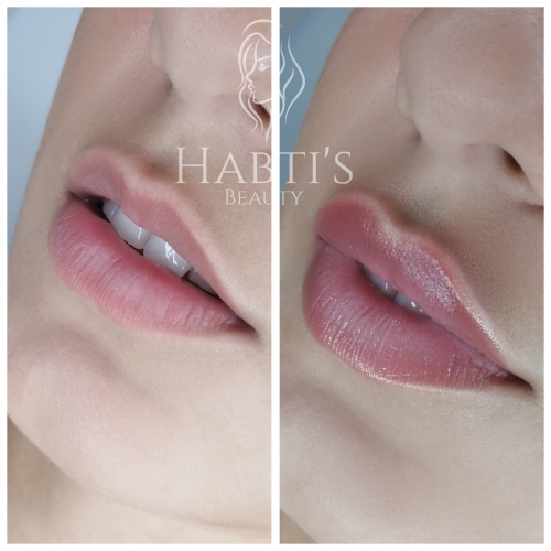 lippen aufspritzen berlin_412459 Lippen aufspritzen Berlin Natürlich Lippen aufspritzen Berlin Lippenunterspritzung Berlin